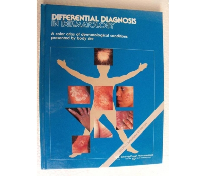 DIFFERENTIAL DIAGNOSIS IN DERMATOLOGY Richard Gibb